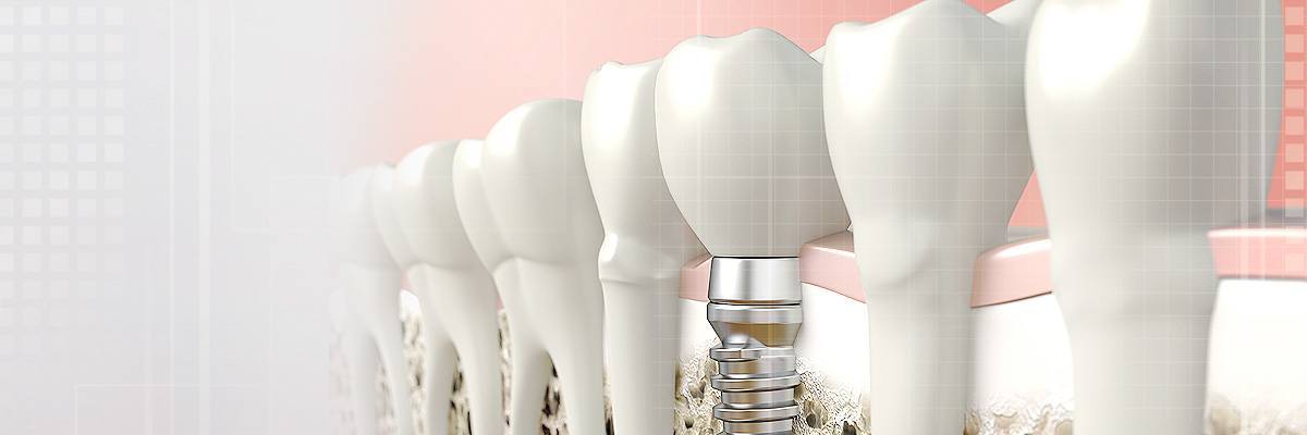 Marietta Dental Prosthetics
